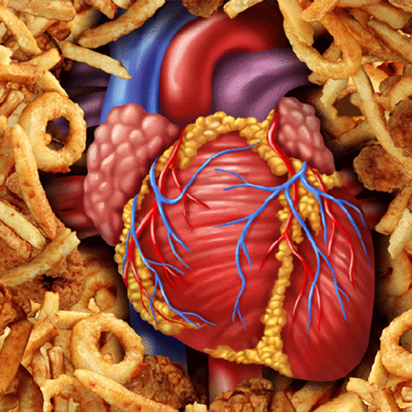 FSSAI working to reduce industrially produced trans fat